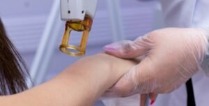 A Comprehensive Guide to Advanced Laser Hair Reduction